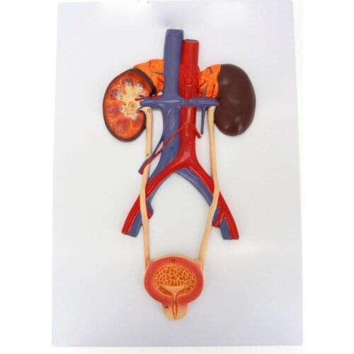 Anatomy Teaching Model Medical Bladder Liver Kidney Wall Plaque Urinary System Teaching Resources
