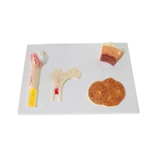 Bone structure model Osteoporosis bone anatomical model Orthopedic teaching model