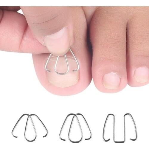 3Pairs Front nail hook/rubber band Nail Art Ingrown Toe Nail Correction Toenail Nail Ingrown Clip Orthosis Paronychia Pedicure