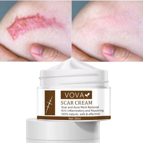 VOVA Scar Removal Cream Pimples Stretch Marks Face Gel Remove Acne Smoothing Whitening Moisturizing Body Cream Skin Care