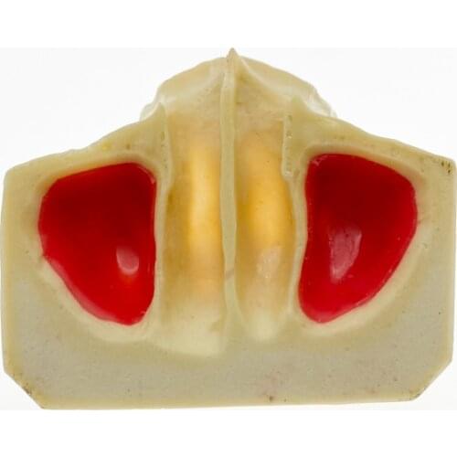 Dental Sinus Lift Practice Teeth Model Typodont Study Model 2013F