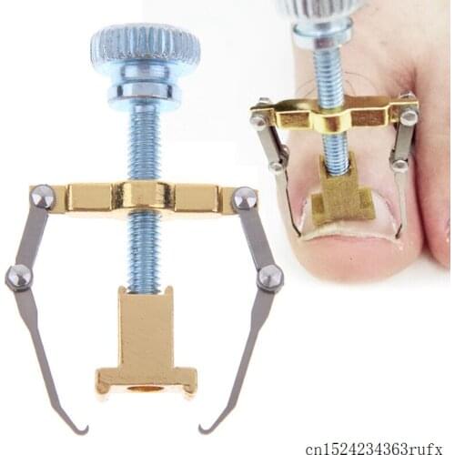 100 Pcs Ingrown Toe Nail Correction Tool Pedicure Fixer Straightener Clippers Manicure Clipper Clamp Scissors Nail Correction