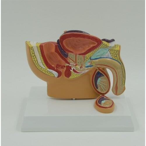 1:2 Human Anatomical Male Prostatitis Organ Dissection Medical Teach Model School Hospital Hi-Q