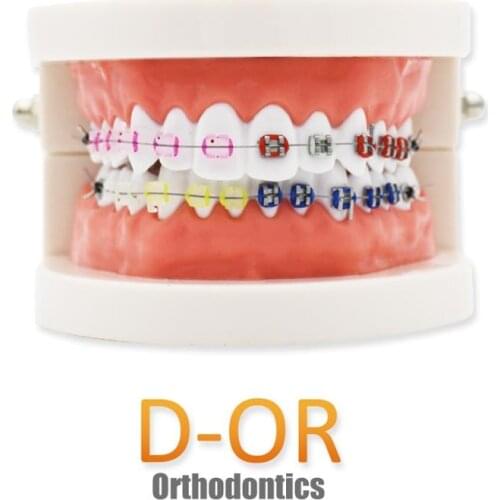 D-OR Teeth Model Dentist student Model for Teaching Dentist Tools Dental Lab Model Caries 6 times tooth
