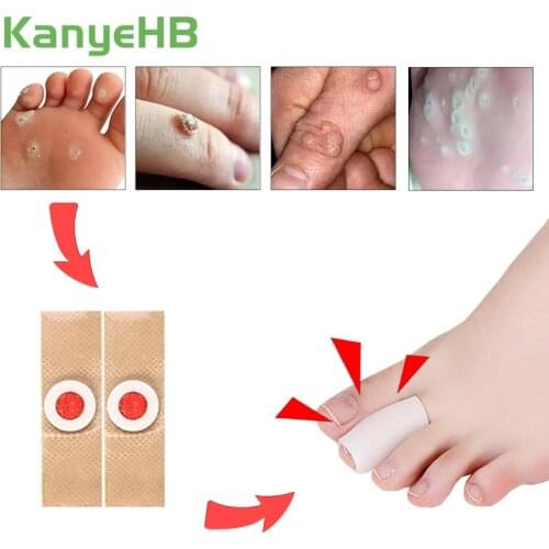 New Type 8pcs Toe Protectors + 24pcs Foot Corn Removal Plaster Medical Plaster Calluses Plantar Warts Thorn Pain Relief Ointment