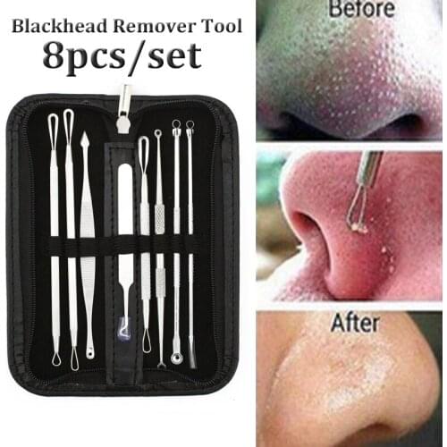 Blackhead Remover Tool Kit Pimple Acne Removal Clip Needle Face Care Comedone Blemish Black Head Extractor 1 Set Free Shipping