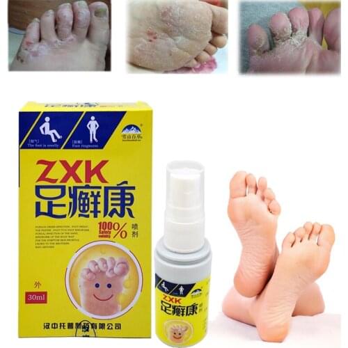 Foot & Shoe Deodorant Spray Feet Care Anti Itch Sweat Odor Feet Athletes Foot Liquid Anti-fungi Shoe Sock Feet Care