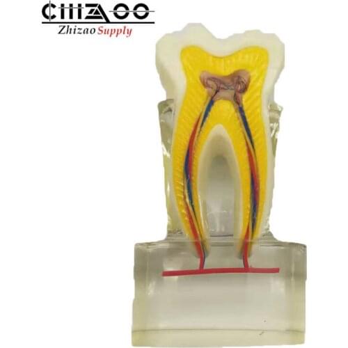 6 Times Oral Teaching Aids Dental Nerve Anatomical Tooth Model