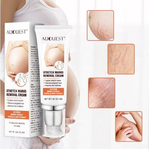 AUQUEST Scar Stretch Marks Removal Cream Maternity for Pregnant Women Body Cream Anti-Winkles Body Care 45g