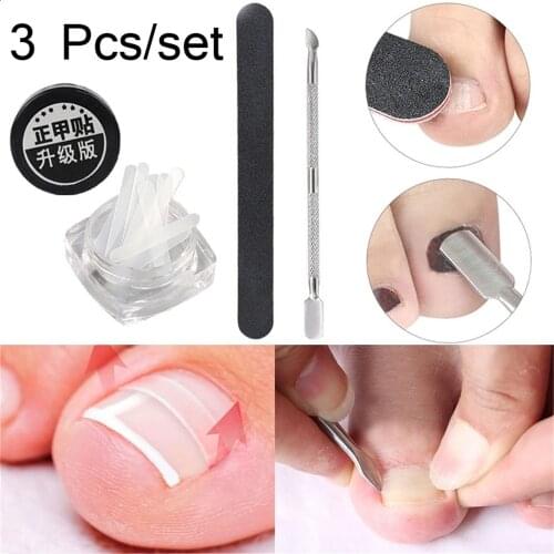 3Pcs/set Professional Ingrown Toe Nail Correction Pedicure Tools Straighten Clip Toenails Protector Treatment Kit Foot Care Tool