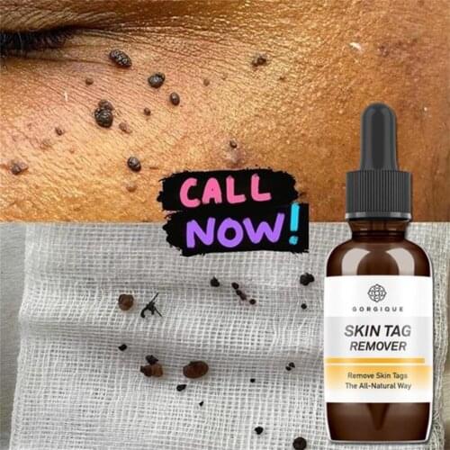 10/20/30ml Skin Tag Remover Mole Foot Corn Wart Care Natural Oil Hyaluronic 100% Serum Pure Acid Essence Essence Quick Results