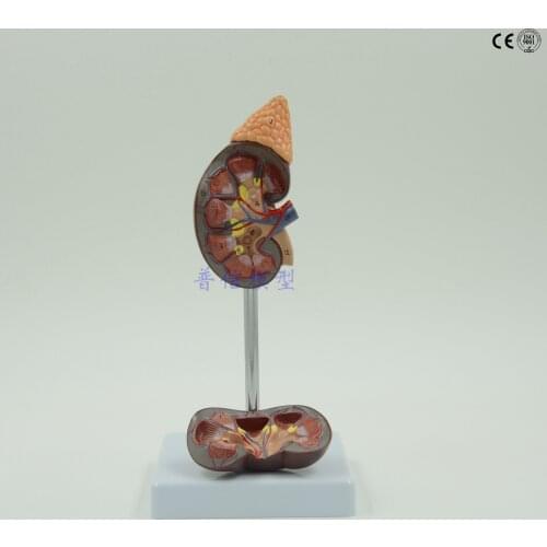 Free shipping&Renal structure, adrenal gland model, urinary system, medical, natural large human renal anatomy model