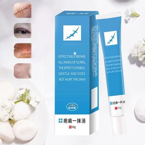 20 Grams Of Scar Cream Acne Spots De-scar Cream Cream Acne for FACIAL Cream Repair Skin Scar Y6D7
