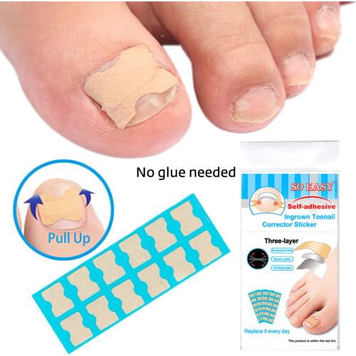 Ingrown Toenails Correction Patch Physical Straightening Elastic Toenail Pedicure Stickers Brace Bunion Corrector Self Adhesive