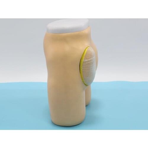 Chinon Advanced Anatomical Structure Hip Muscle Injection Model Medical Science Education Student Teaching ToolsVBIX-H4T