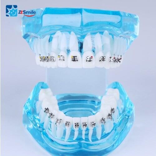 Teeth Model for Studying/Dental Teeth Model/Teeth Model with Metal Brackets M3001