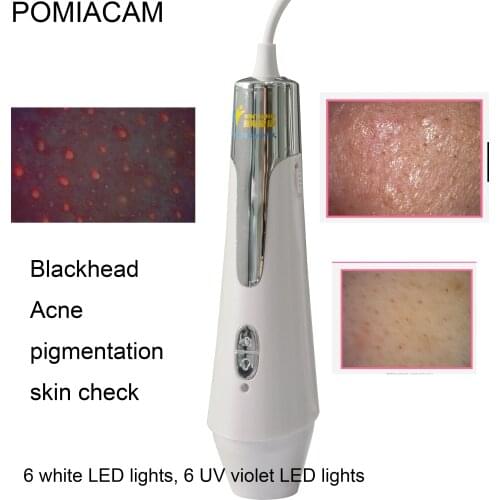 IS6 skin Microscope Magnifier Camera 6 UV purple LED lights Ai Intelligent skin analysis system Windows Android