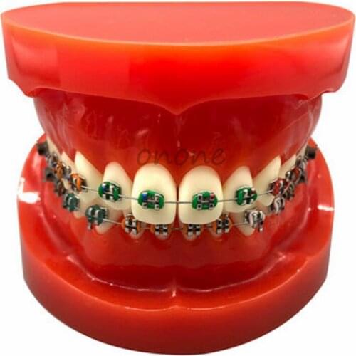 1pcs Dental Orthodontics Typodont Teeth Model Metal Brace Bracket Typodont with Arch Wire Orthodontic Correction