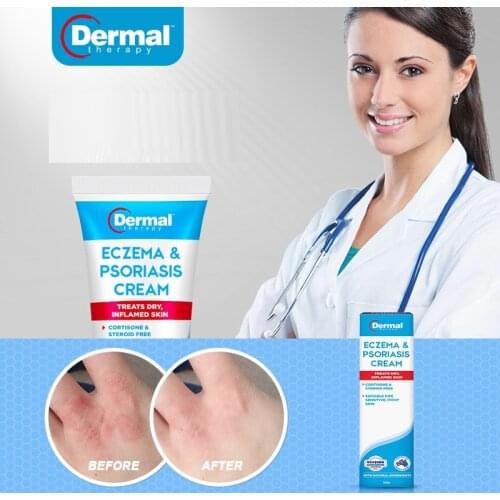 Dermal natural Therapy Dermatitis Urticaria Eczema Psoriasis Moisturizing Management Cream for Dry Inflamed Sensitive Itchy Skin