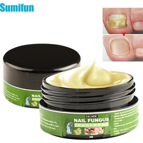 1Pcs New Fungal Nail Treatment Oil Antibacterial Repair Ointment Whitening Toe Anti Infection Nail Repair Cream Nail Care