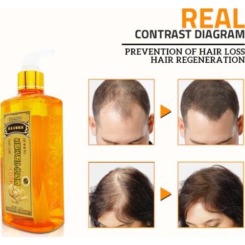 Ginger Shampoo Anti Hair Loss Baldness Dandruff Effective Nourishing Moisturizing EF