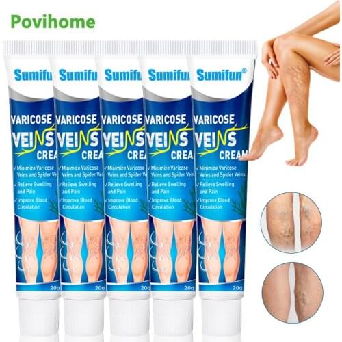 5Pcs Sumifun Varicose Veins Ointmnet Phlebitis Vasculitis Treatment Cream Spider Removal Pain Relief Medical Plaster Body Care
