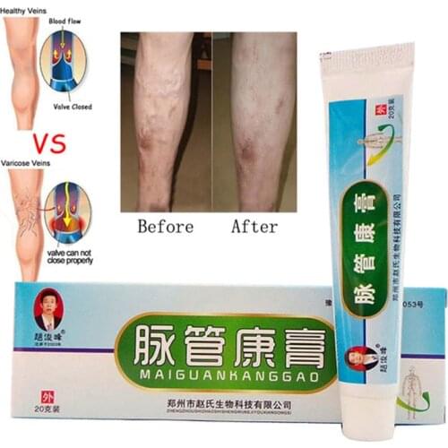 10 pcs Chinese natural herbal medicine for treating varicose vascular inflammation massage cream cure varicose vein ointment