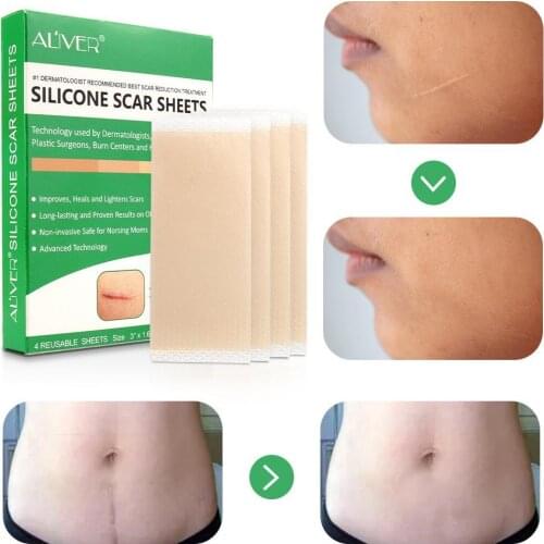 Repair Scar Patch Cream Scar Removal Maternity Surgery Caesarean Bump Scar Stretch Mark Scald Remove Stickers