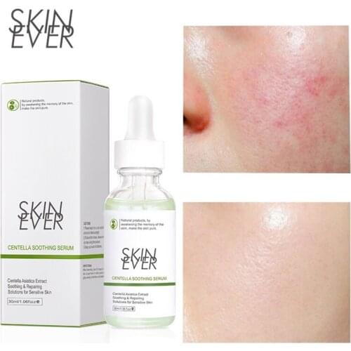Centella Moisturizing Serum Anti-aging Brighten Whitening Oil Control Essence Anti-acne Soothing Repair Reddish Sensit Skin Care