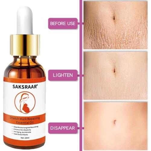 Stretch Marks Remover Essential Oil Eliminate Pregnancy Scars Maternity Repair Anti Winkle Skin Firming Treatment