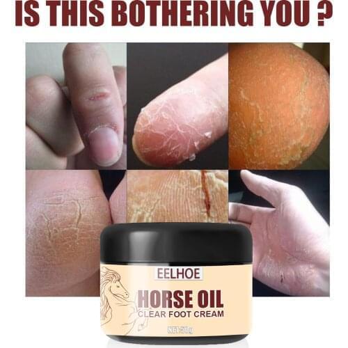 High Quality Horse Oil Cream for Foot & Hand Antifreeze Moisture Heel Gel for Chapped Peeling Dry Skin 20/30/50g