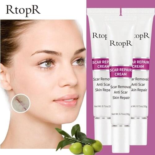 3PCS Acne Scar Stretch Marks Remover Cream Skin Repair Face Cream Spots Acne Treatment Blackhead Whitening Cream Skin Care 3pcs