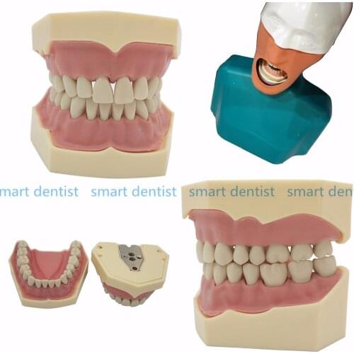 2018 Dental Soft Gum Teeth Model Removable 28pc/32pc Teeth NISSIN 200 KAVO head model Compatible dentist teaching learni