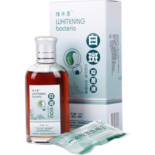 Professional White Spot Antibacterial Liquid Chinese Medicine Care Solution 50ml Skin Vitiligo Treatment For Leukoplakia Disease