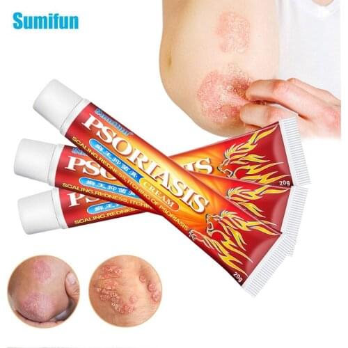1Pcs 20g Sumifun Psoriasis Treatment Cream Pruritus Eczema Dermatitis Ointment Antibacterial Anti-Itching Herbal Medical Plaster