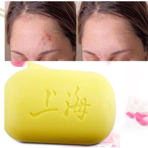 Soap Oil-control Acne Treatment Blackhead Remover Skin Care Bath soaps Remove the mites Body Back Acne fresh air Bathroom Supply