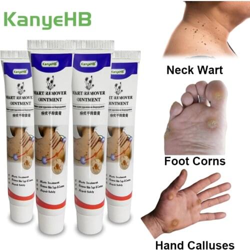 4pcs Skin Tag Remover Cream Wart Ointment Rapidly Dispel Foot Corn hand Calluses Warts Papillomas moles Medical ointment A636