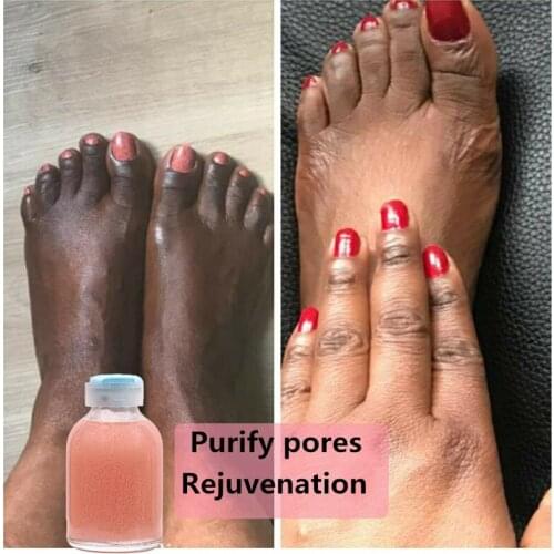 30ml Strong Hand and Feet Lightening Whitening Cleansing Serum To Clean Up Dark Knuckles Melting and brightening the skin