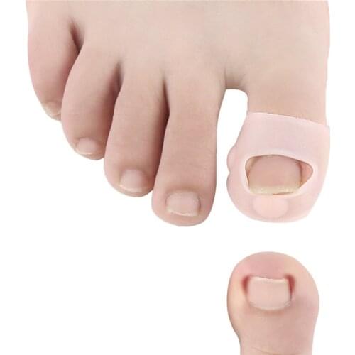 1Pair Silicone Ingrown Toenail Correction Tool Invisible Ingrown Toe Nail Treatment Elastic Straightening Clip Brace