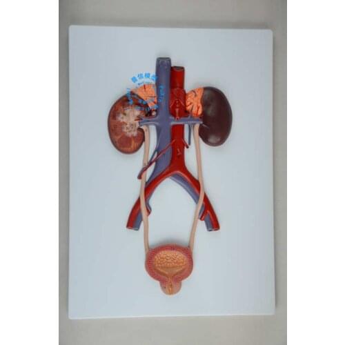 Free shipping&Human urinary system model (Semi-solid), human kidney model, arteries and veins model, human anatomy model