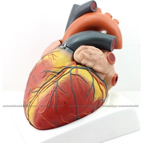 CMAM/12487 Giant Heart - 4 Parts, 4X life size, Human Heart Medical Teaching Anatomical Model