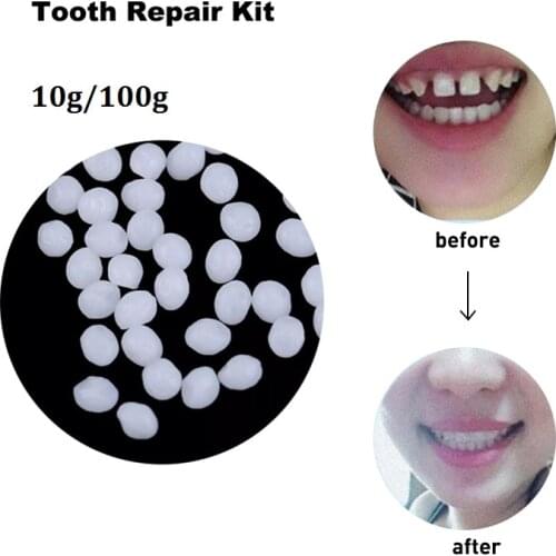 10g/100g Denture Solid Glue Oral Care Dental Restoration Temporary Tooth Repair Kit Teeth And Gaps FalseTeeth Adhesive Tool