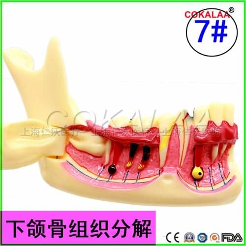 Good quality Mandibular tissue decomposition model dental teeth model dentures teeth model for dentists learning