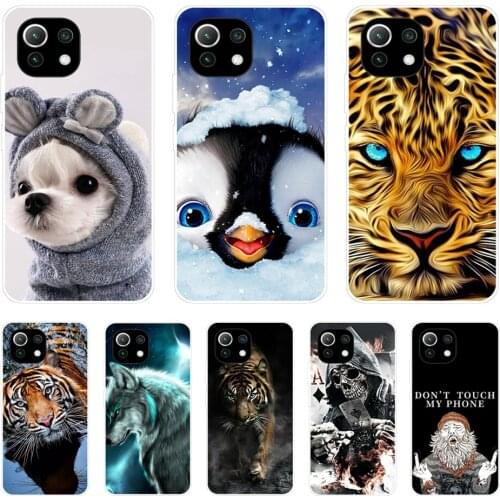 For xiaomi Mi 11 | Mi 11 Lite 4G 5G| Mi 11i | Mi 11 Ultra Case Back For xiaomi11 i 11Lite Phone Cover Xiomi Mi11Lite Silicon TPU