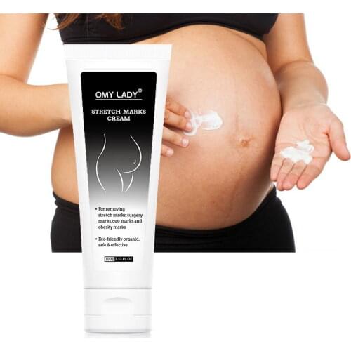 OMY LADY Effective Remove Stretch Marks Cream Fade Stretch Marks Obesity Marks Surgery Scar Pregnant Scar Removal Skin Care