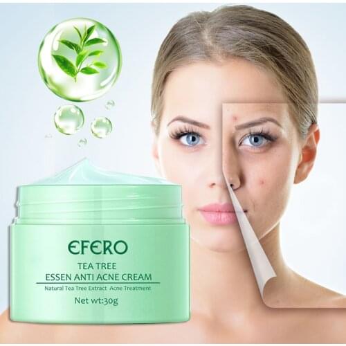 EFERO 5-20Pcs Effective Acne Removal Cream Acne Whitening Moisturizing Face Cream Deep Cleansing Skin Shrinking Pore Acne Cream