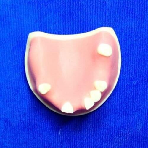 Imitating bone in the model of missing maxillary teeth Dental implant placement training Dental implant placement training