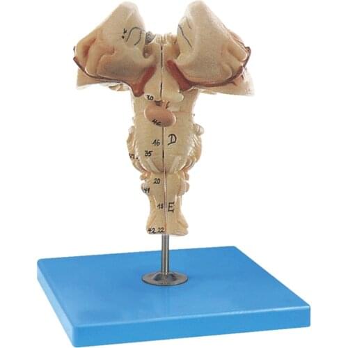 Human Brain Anatomy Model Cerebral Arteries Brain Stem Removable Brain Stem Magnification Model Medical Educational Aids