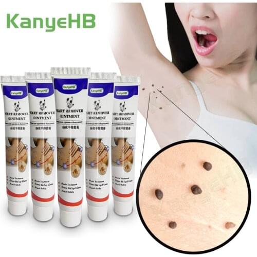 5pcs New Arrivals KanyeHB Wart Remover Ointment Wart Treatment Cream Skin Tag Remover Corn Plaster Warts Antibacterial CreamA637