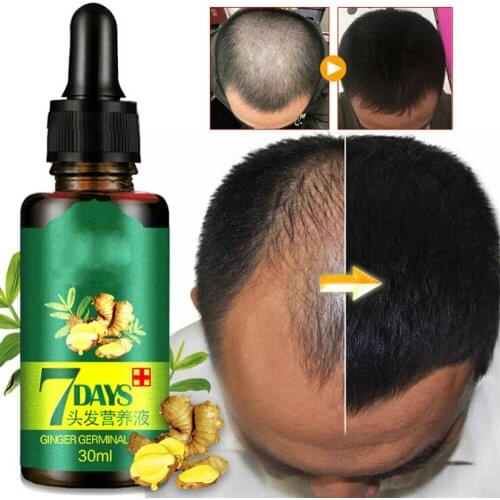 Original 100% Brand New 7 Days Germinal Hair Growth Essence Oil Hair Loss Growth Hair Treatement for Men/Women Invalid Refund